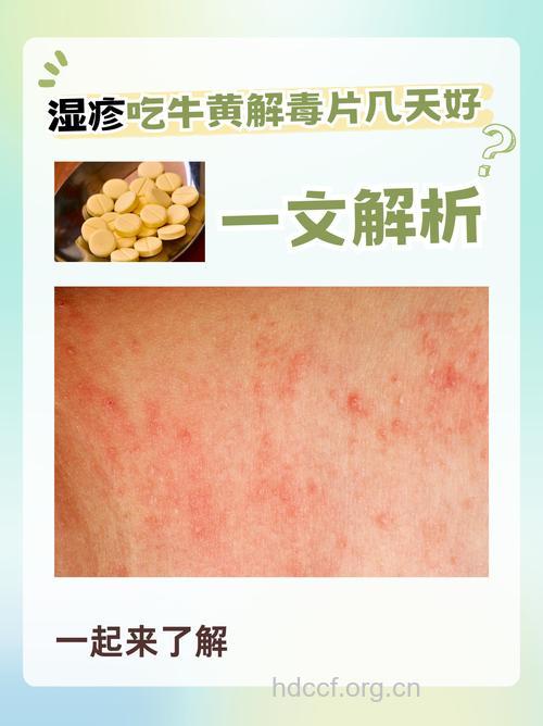 牛黄解毒片也可引起药疹？