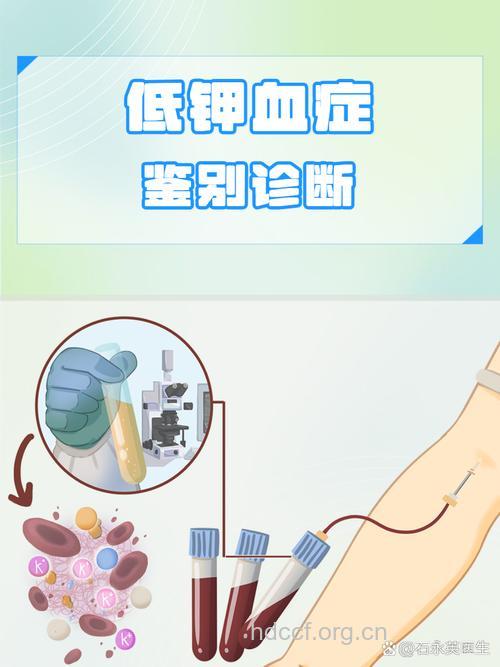 没事乱输葡萄糖 小心低钾血症