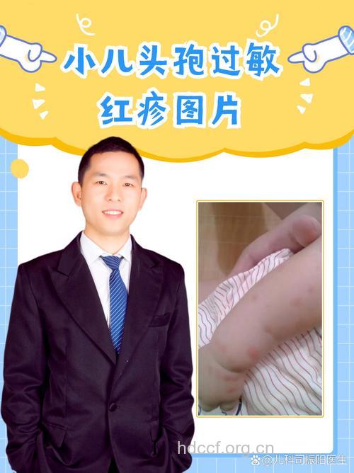 警惕：有些药物可诱发小儿药疹