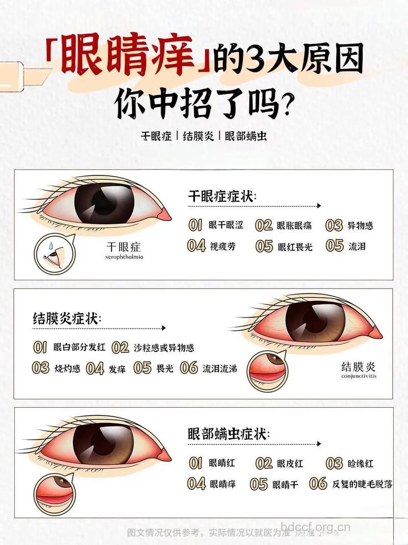 老年人眼睛奇痒 该如何治疗?