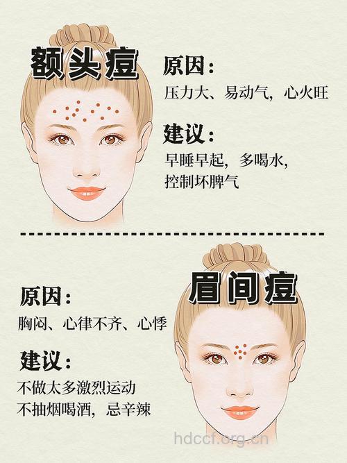 中医教您看痘识病(图解)
