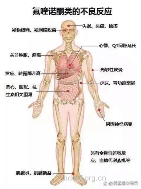 喹诺酮的不良反应