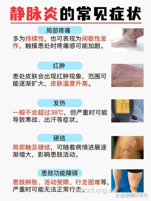大剂量应用抗生素小心引起静脉炎