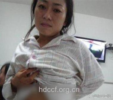 未孕的妻子居然溢乳