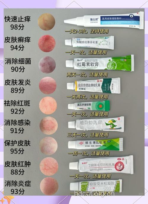 皮肤病如何合理选用药物?