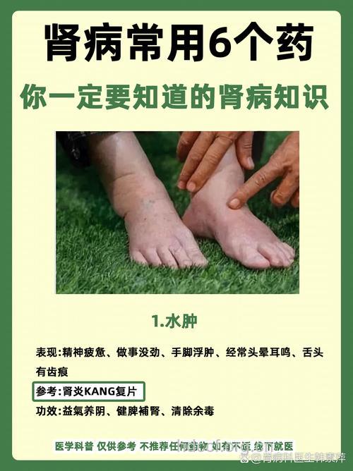 出现哪些症状需警惕药源性肾损害?