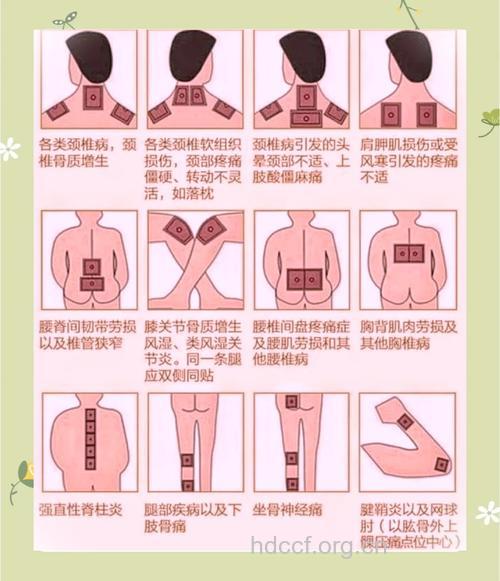 贴膏药需注意的几个细节