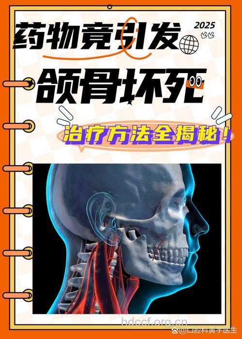 为何双磷酸盐类药物可导致骨坏死?