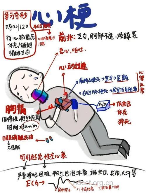 心绞痛服用硝酸甘油 讲究方法和姿势