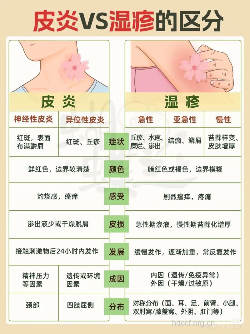 皮炎还是癣病,如何分辨清楚?