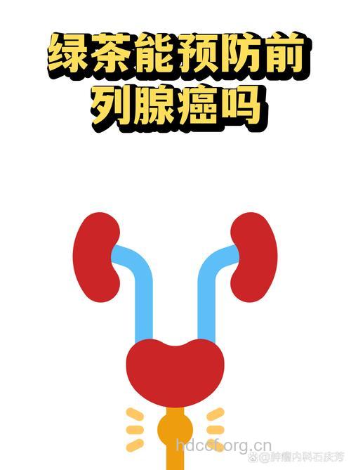 绿茶+还氧合酶-2可延缓前列腺癌扩散