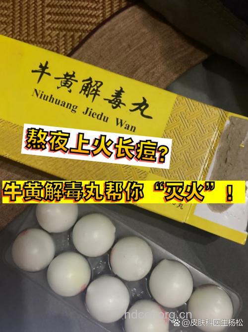 牛黄解毒丸祛痘痘、痤疮,可信吗?