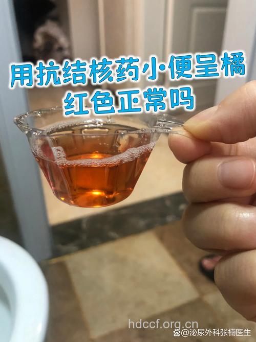 吃不同的药可能使小便变色