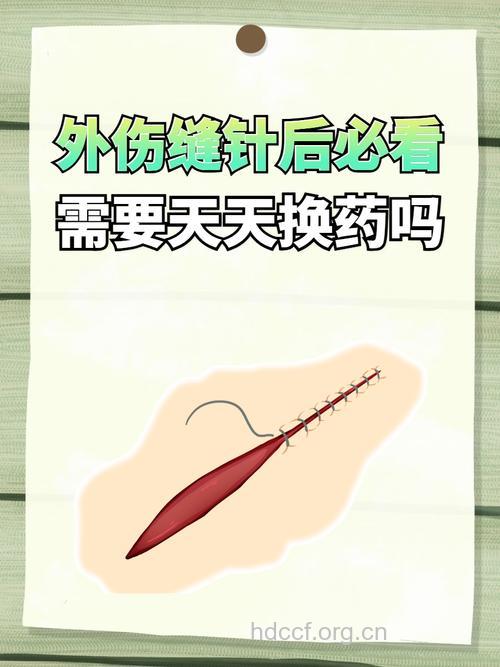 伤口需每天换药吗?