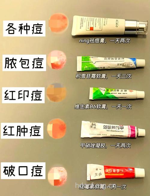 痘痘不是药物可以治疗的,要注意自身生活习惯!