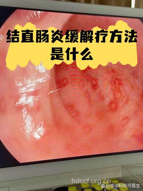 早期肠黏连患者 试试“肠黏连松解汤”