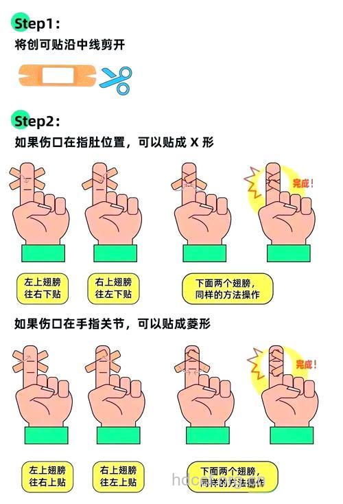 你知道怎么贴创可贴吗?