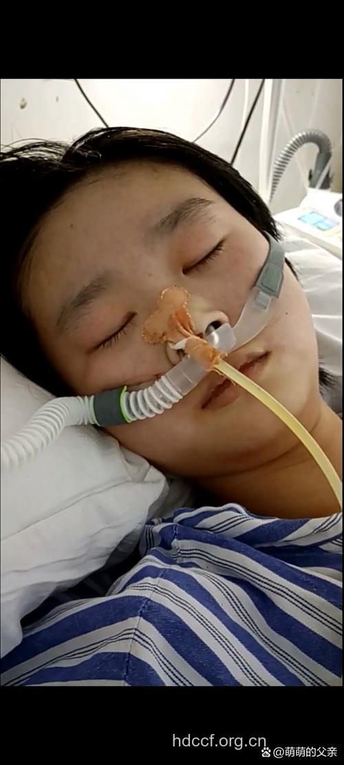 女孩减肥药上瘾患“心病”