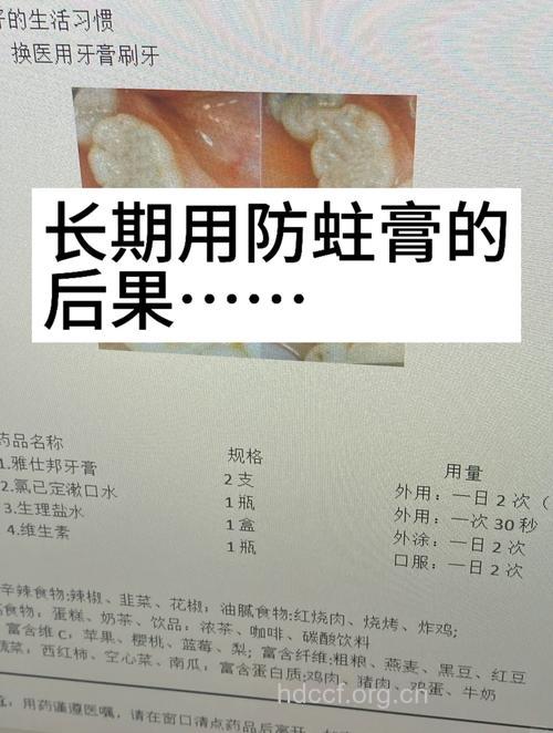 如何用药预防龋齿