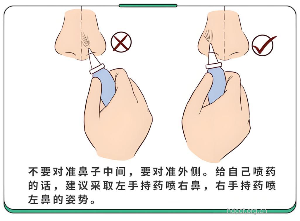 如何合理使用滴鼻剂