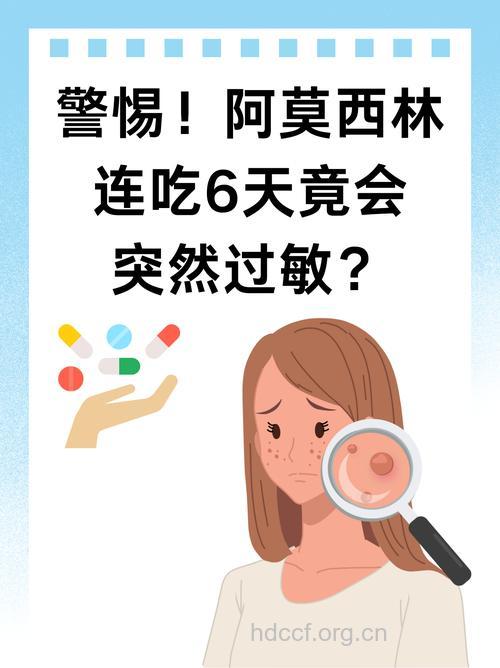小心吃了抗过敏药加重过敏