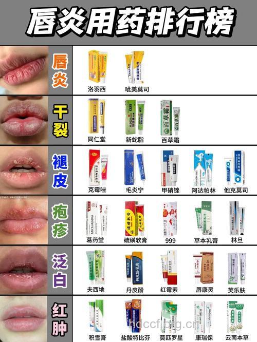 烂嘴角用药不能与中药合用