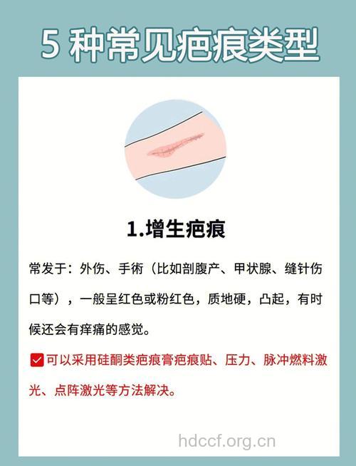 快速去疤的几个小巧招
