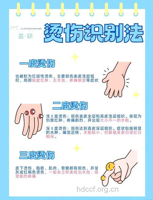 手脚被烫伤该如何用药？