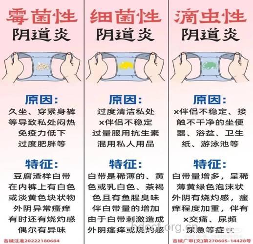滴虫性阴道炎该注意哪些事项
