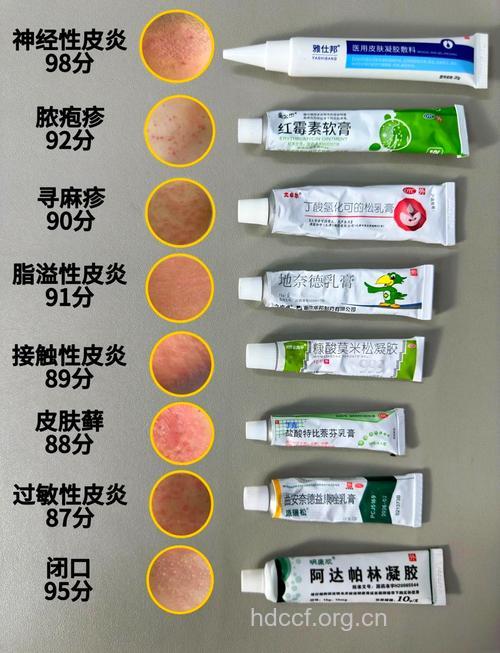 四类皮肤疾病不适合使用激素软膏