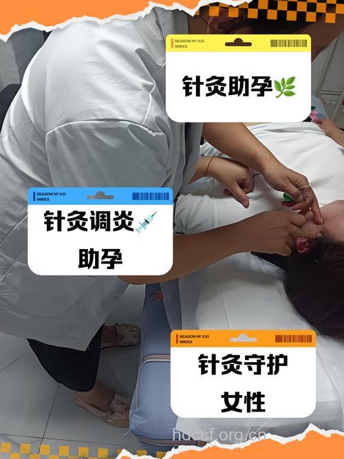 产后适合做针灸减肥吗?