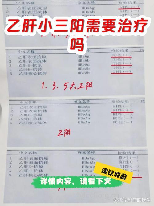 假“小三阳”也需治疗
