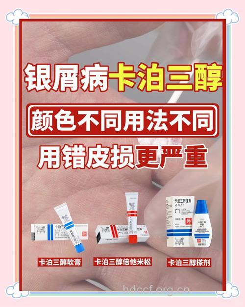 银屑病该如何选择适合自己的药