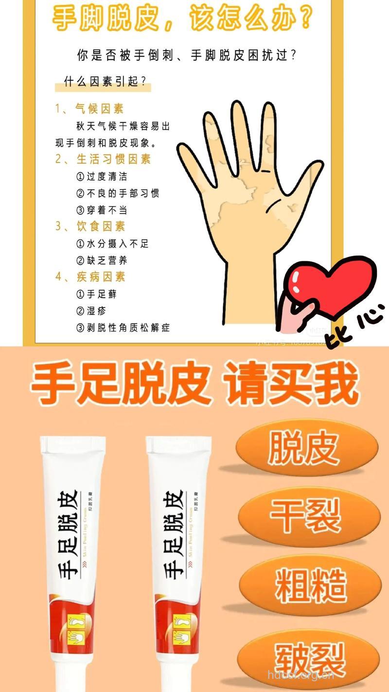 手足皲裂要坚持上药