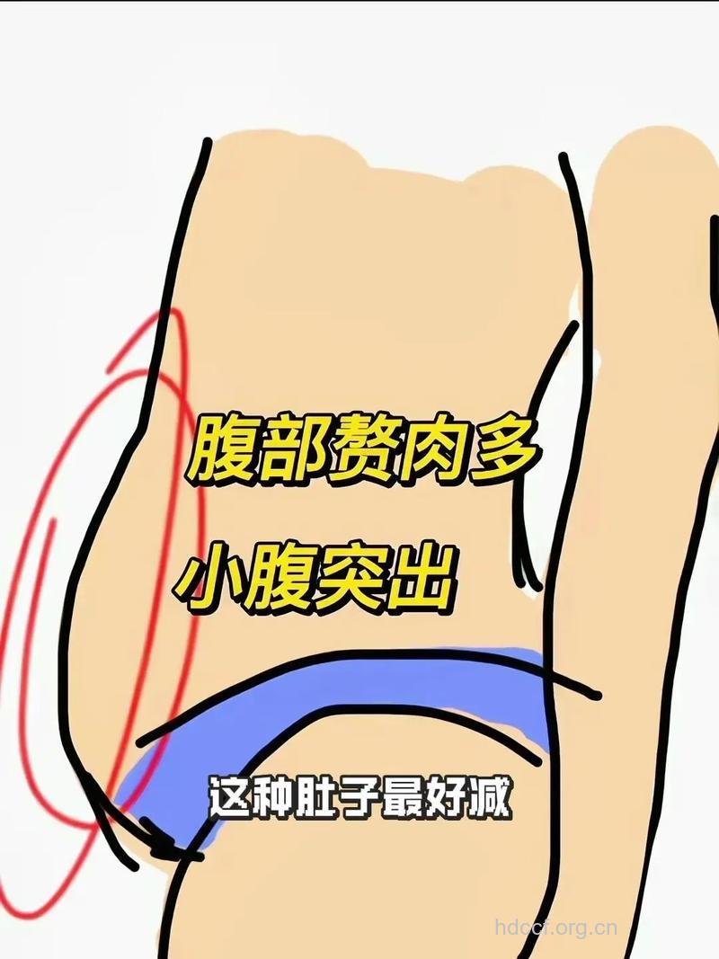 有哪些告别“小腹婆”方法