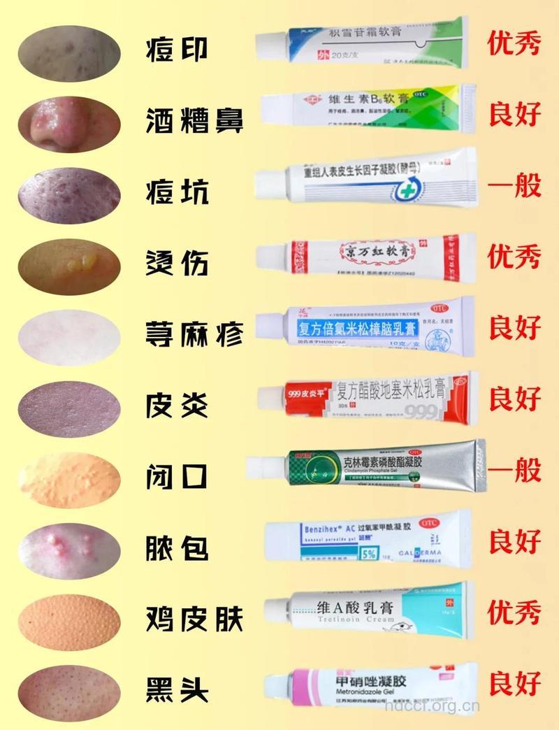 秋季皮炎用药应如何选择?