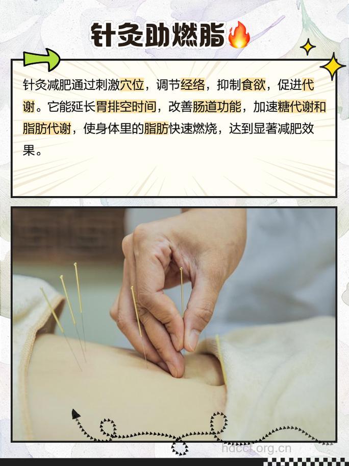 针灸减肥有哪些方式