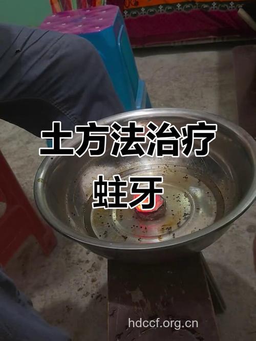 常用于龋病防治的四类中药