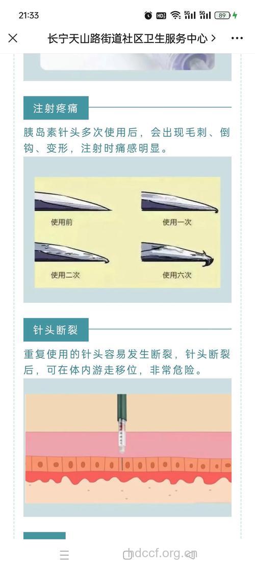 胰岛素注射器针头切勿反复利用