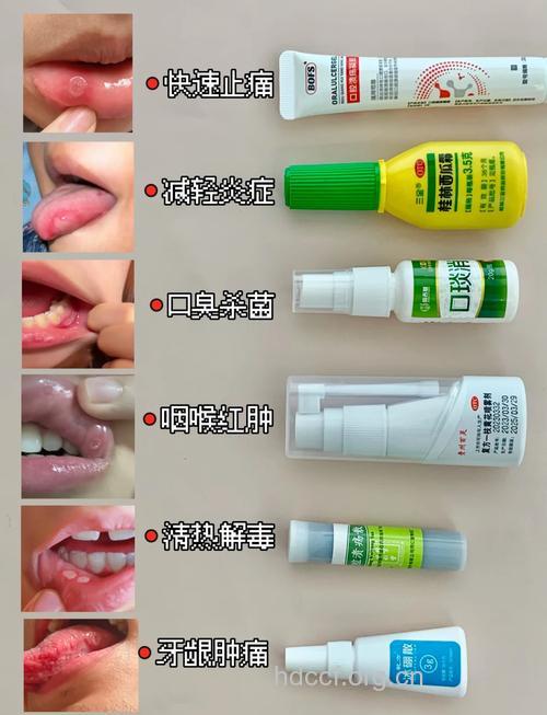 口腔溃疡 如何对症下药?