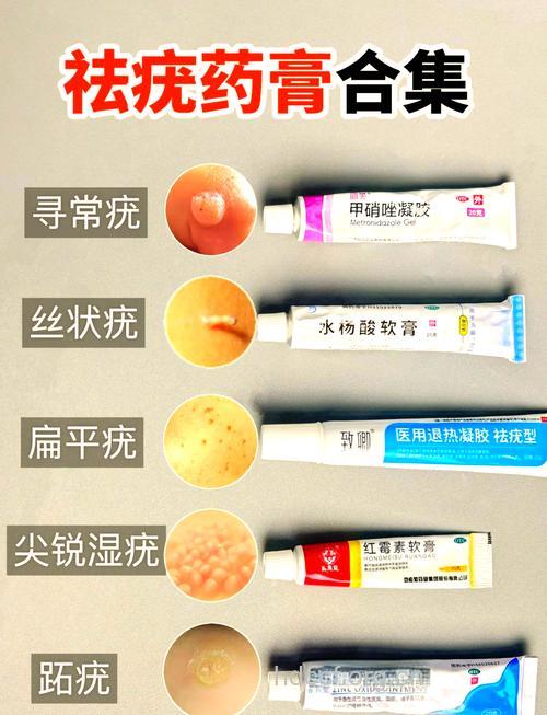 顽固扁平疣的治疗用药