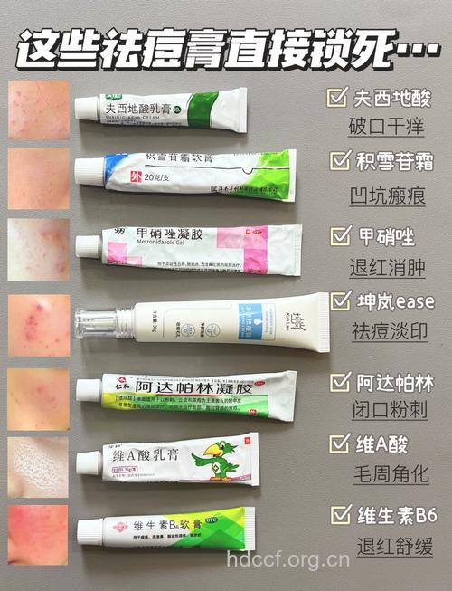 水痘如何治疗用药?