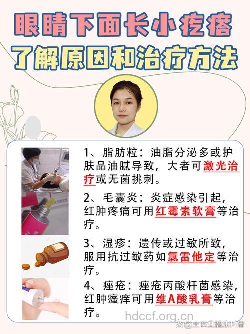 维甲酸治疗青春痘哪些需注意?