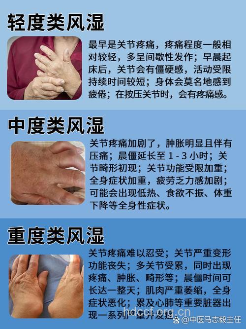 我国在类风湿性关节炎领域有了新突破