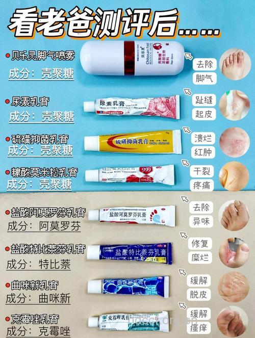 脚气可口服抗真菌药联合外用药