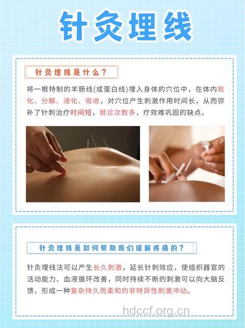 埋线减肥治疗机理是什么