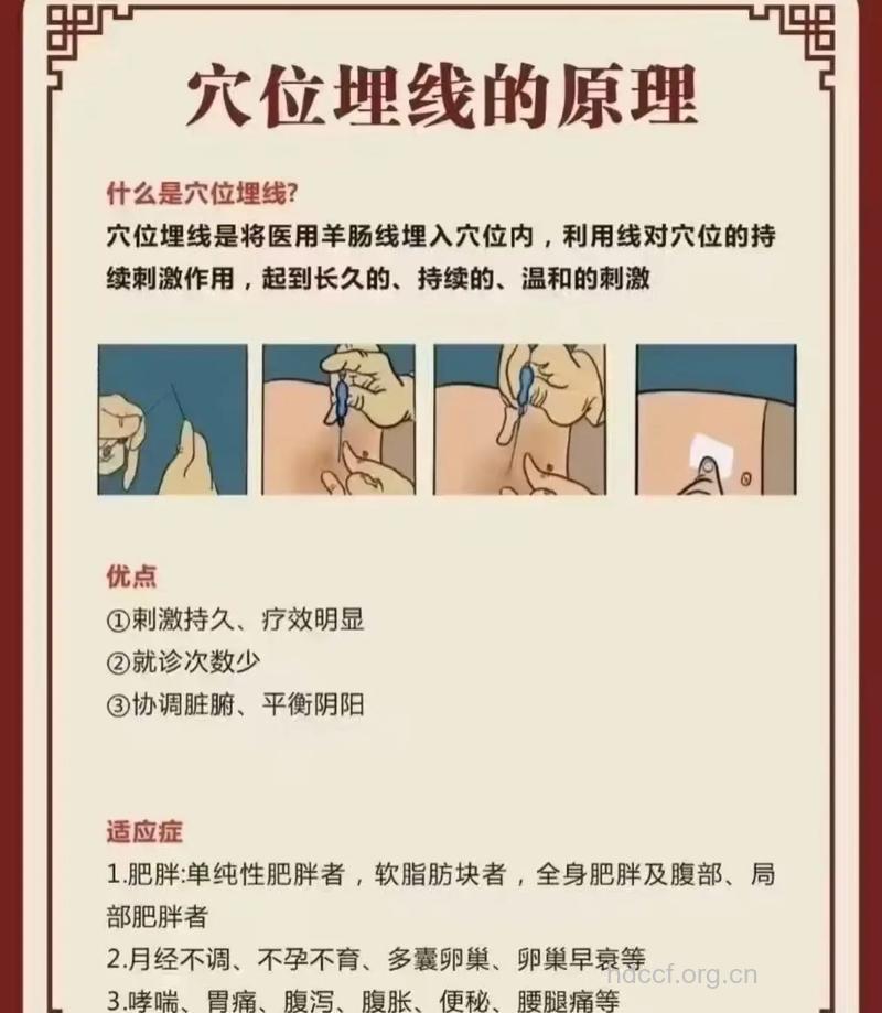 什么是穴位埋线减肥疗法?