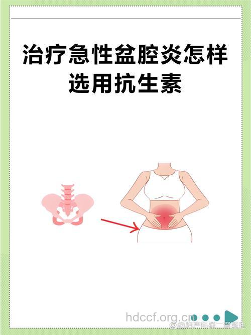 急性盆腔炎 如何正确选择抗生素?