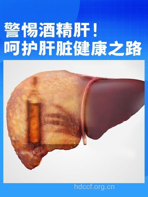 探索酒精肝的最新疗法