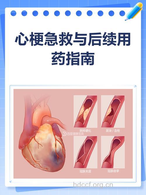急性心肌梗死急救用药注意哪些?